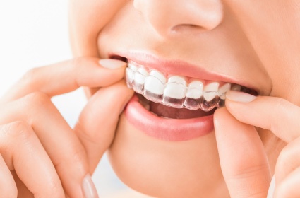 İnvisalign